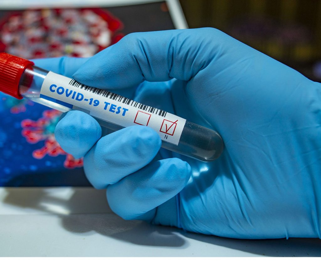 Des pèlerins revenant de la Mecque testés positifs à la Covid-19