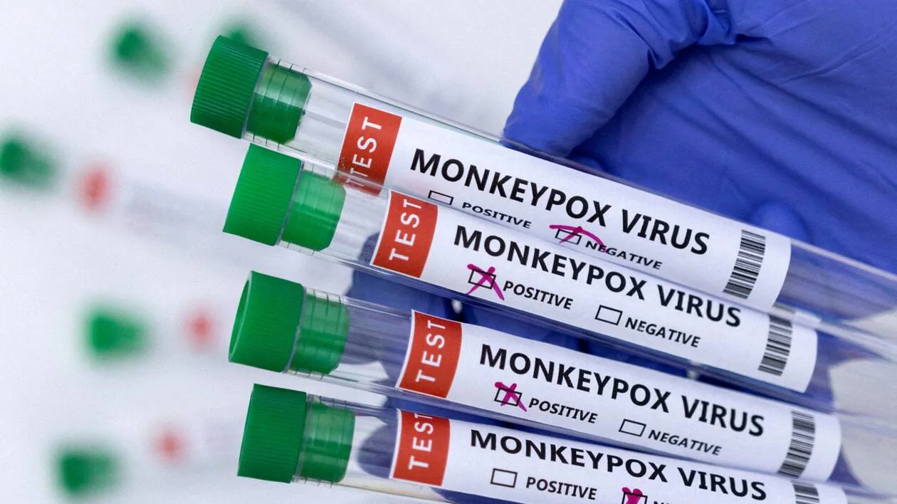 Six cas de variole du singe confirmés en Côte d'Ivoire
